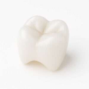 E.max dental crown