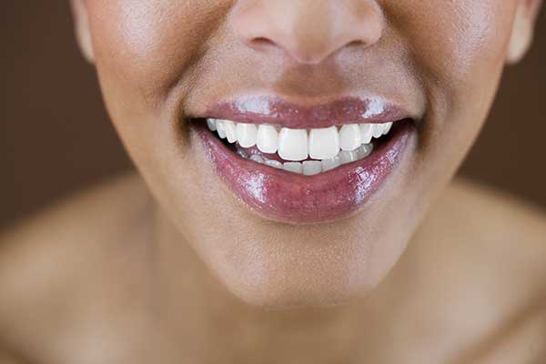 Dental Bonding in Austin TX at Austin City Dental